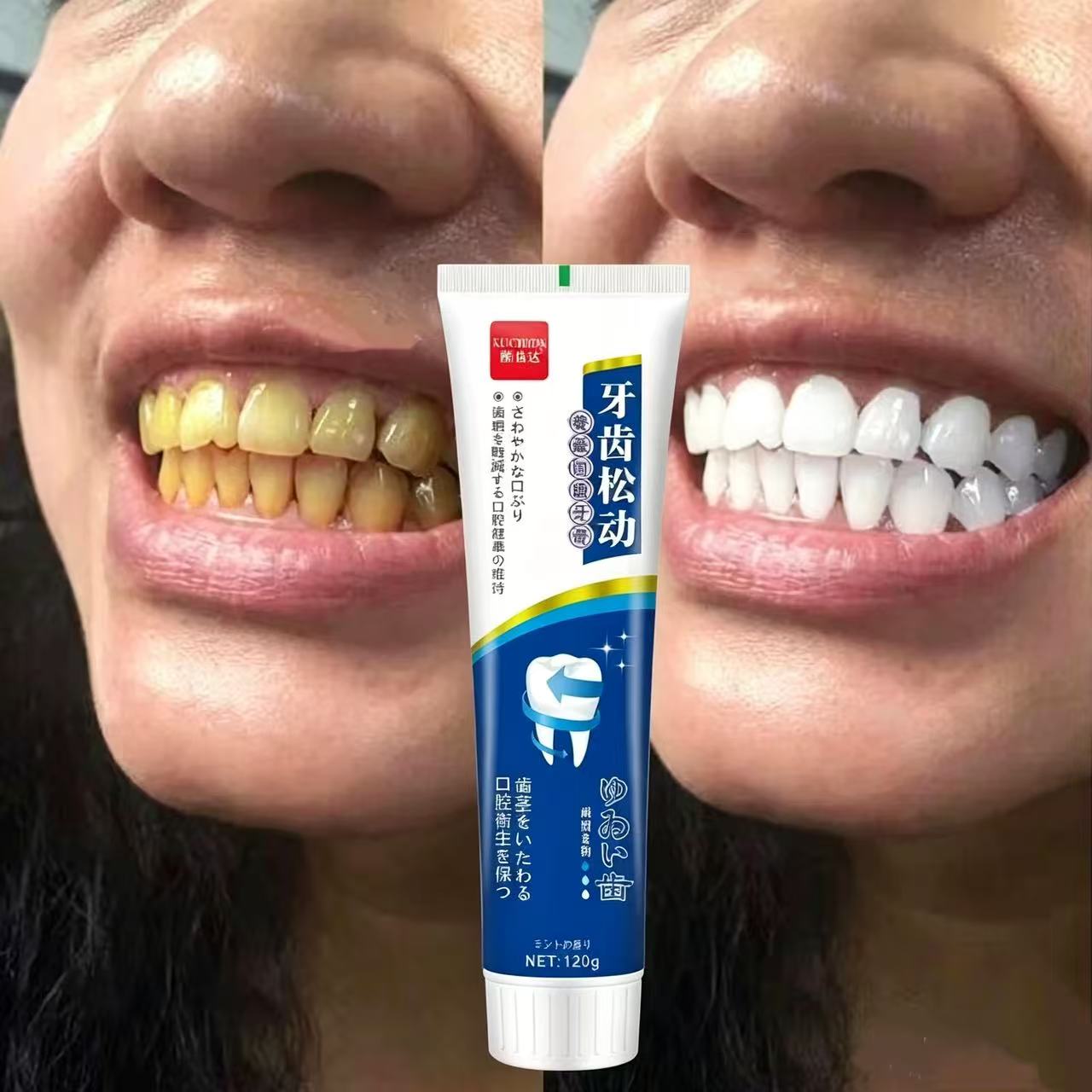 Teeth Whitening Japanese - Dökülen dişleri onarıcı Japon ithal diş