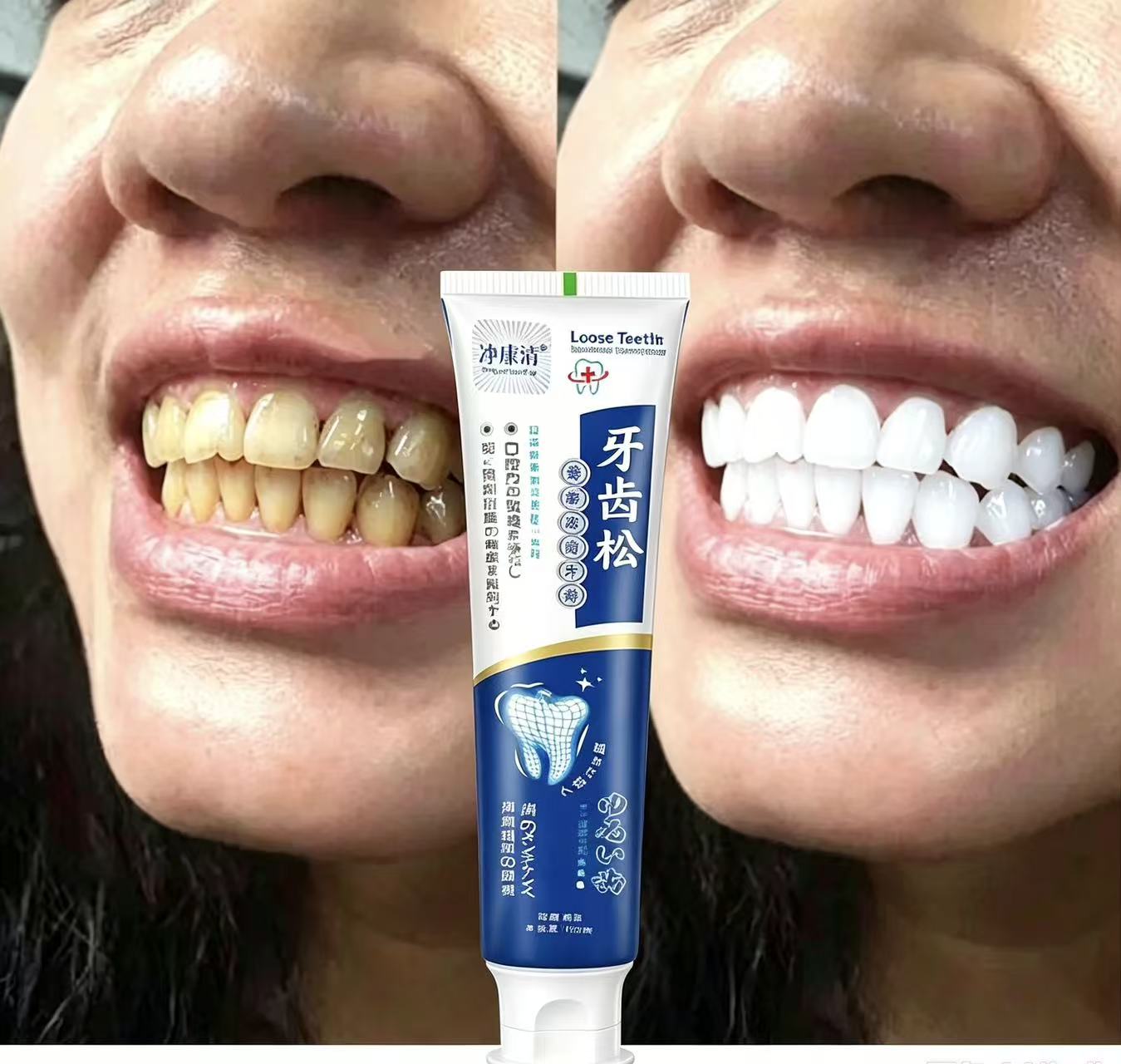 Teeth Whitening Japanese - Gevşek Dişleri Onarır Japon İthal Diş