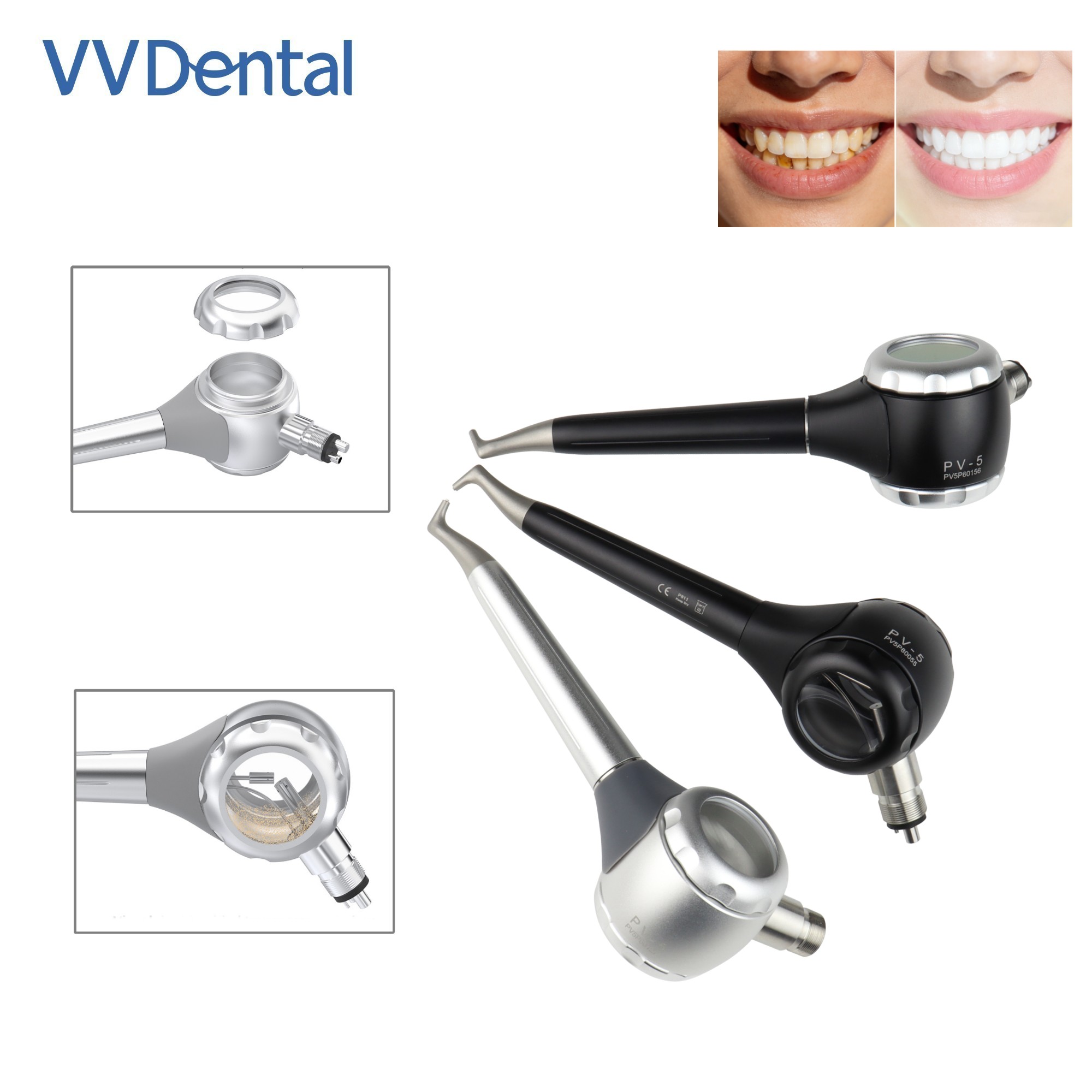 Teeth Whitening Free - VV Dental 2/4 Delikli Diş Beyazlatma
