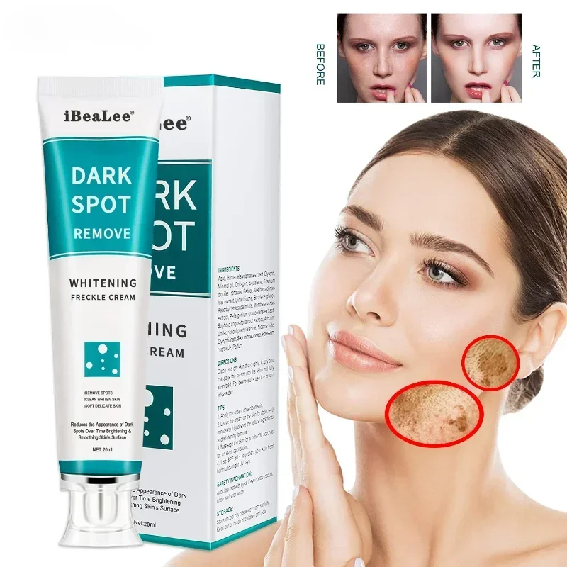 Charcoal Whitening Paste - Beyazlatma çil krem kaldır koyu noktalar