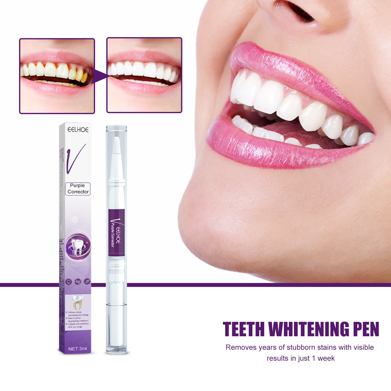 Whitening Pen Bleach - Mor Diş Beyazlatma Diş Macunu Kalem