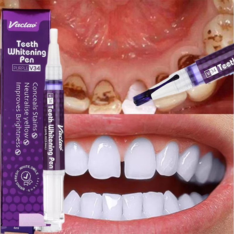Whitening Pen Bleach - V34 Diş Beyazlatma Kalemi Diş Macunu