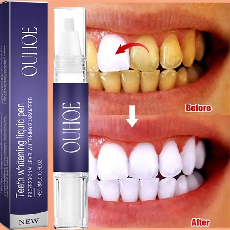 Whitening Pen Bleach - Hızlı Diş Beyazlatma Diş Macunu Kalem