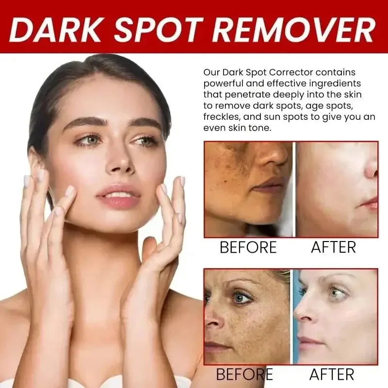 Güçlü Leke Giderici Beyazlatıc - Charcoal Whitening Paste incelemesi ve fiyatı