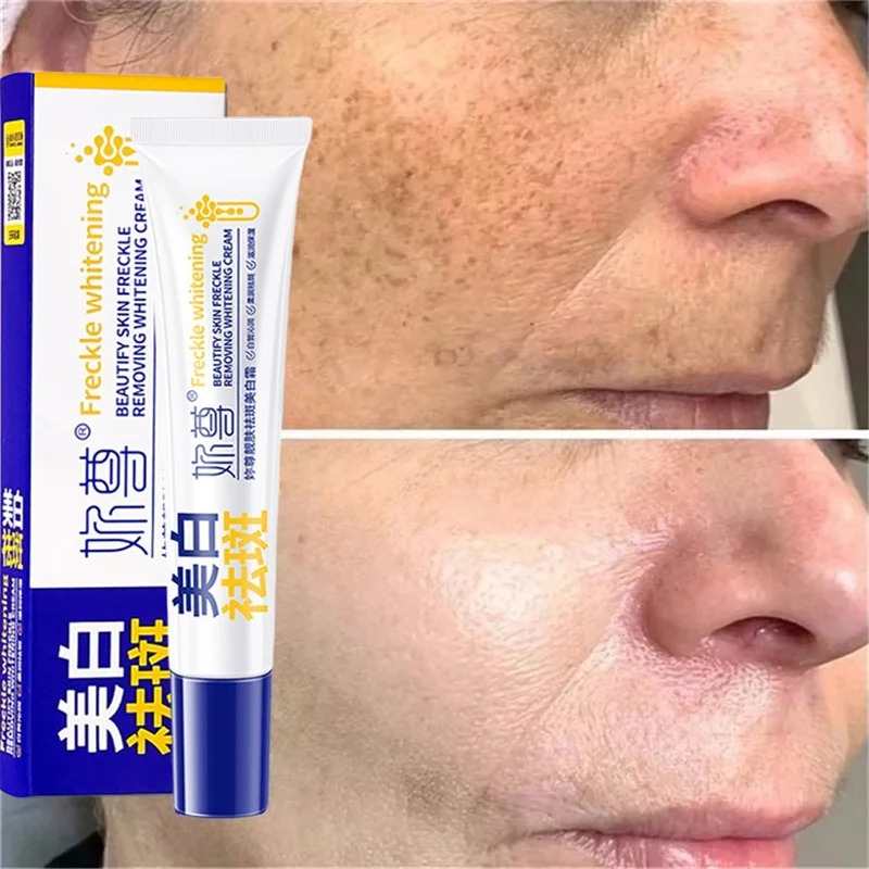 Güçlü Leke Giderici Beyazlatıc - Charcoal Whitening Paste incelemesi ve fiyatı