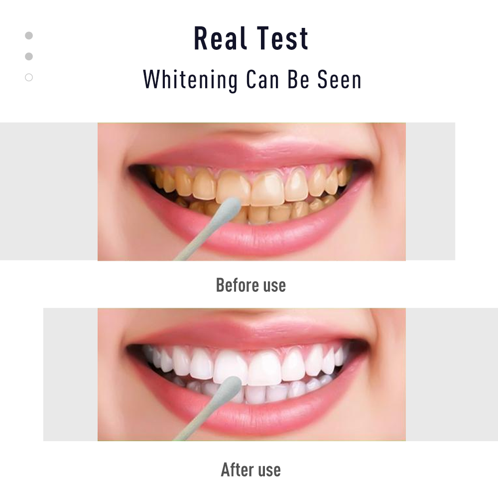 Kalem diş jeli beyaz kiti temi - Whitening Pen Bleach incelemesi ve fiyatı