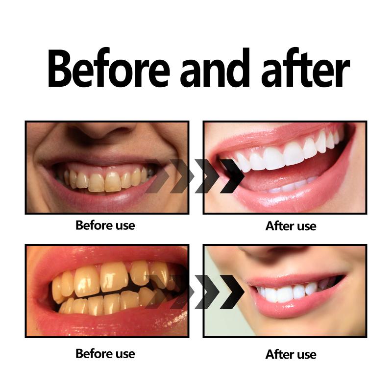 Diş Beyazlatma Tozu Kömür / Ka - Teeth Whitening Baking Soda incelemesi ve fiyatı