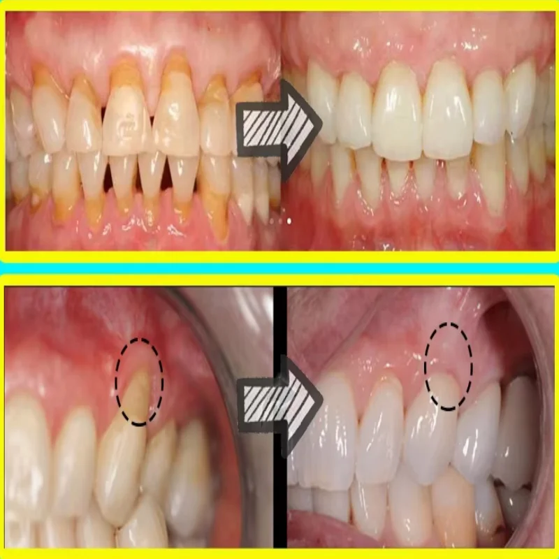 Hızla Onarım Sakız Serumu Raha - Teeth Whitening Baking Soda incelemesi ve fiyatı
