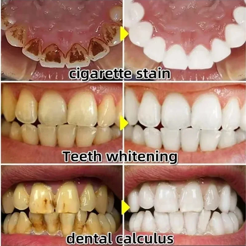 Hızla Onarım Sakız Serumu Raha - Teeth Whitening Baking Soda incelemesi ve fiyatı