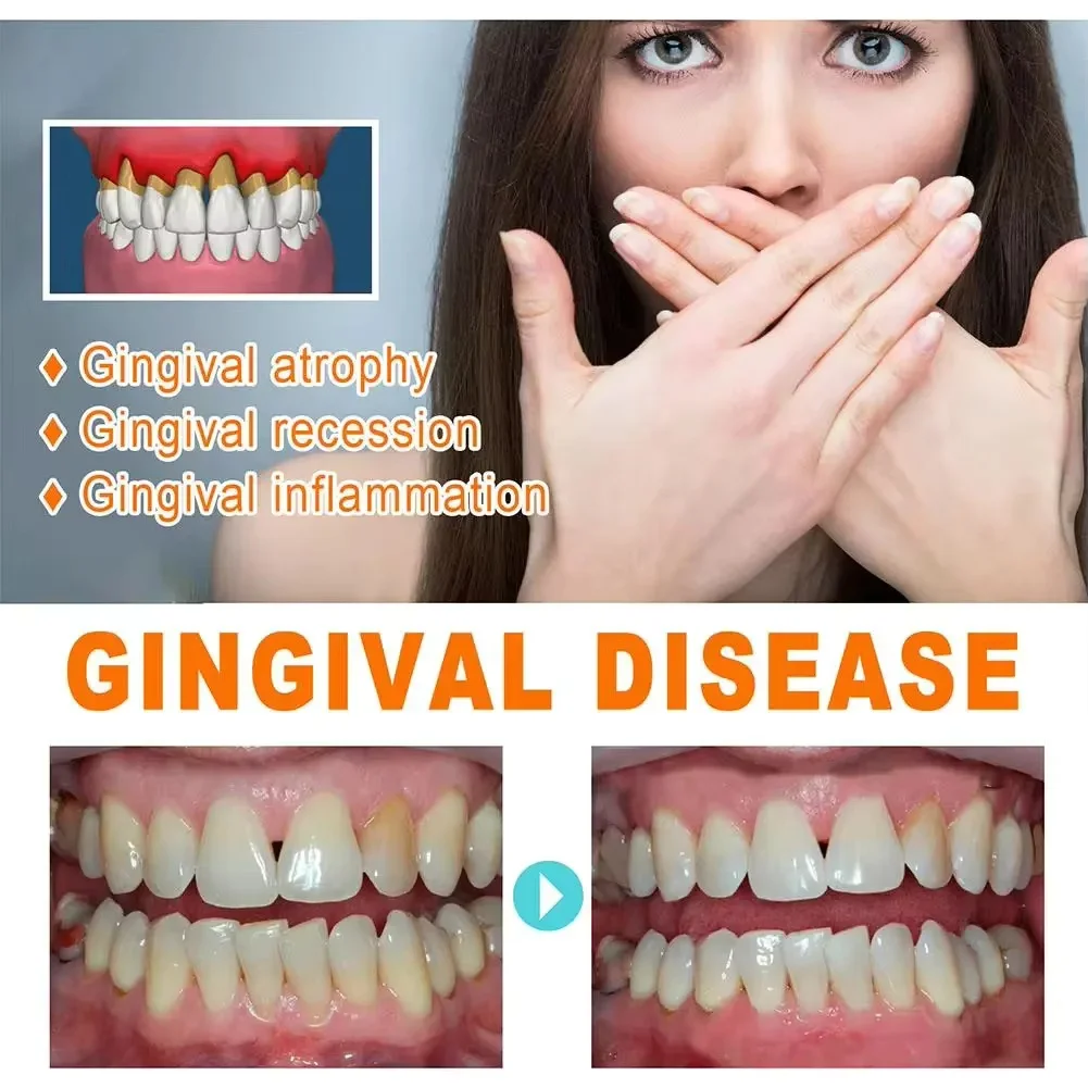 Hızla Onarım Sakız Serumu Raha - Teeth Whitening Baking Soda incelemesi ve fiyatı