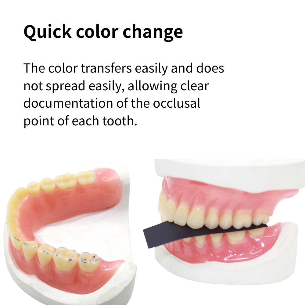 AG 300 Yaprak/Kutu Diş Artikül - Teeth Whitening Retainer incelemesi ve fiyatı