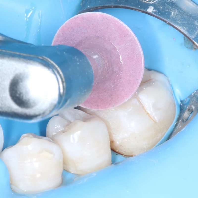 40 adet diş parlatma diski kom - Teeth Whitening Professional incelemesi ve fiyatı