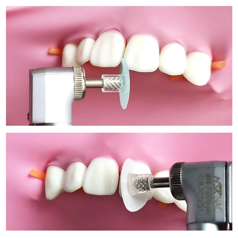 40 adet diş parlatma diski kom - Teeth Whitening Professional incelemesi ve fiyatı
