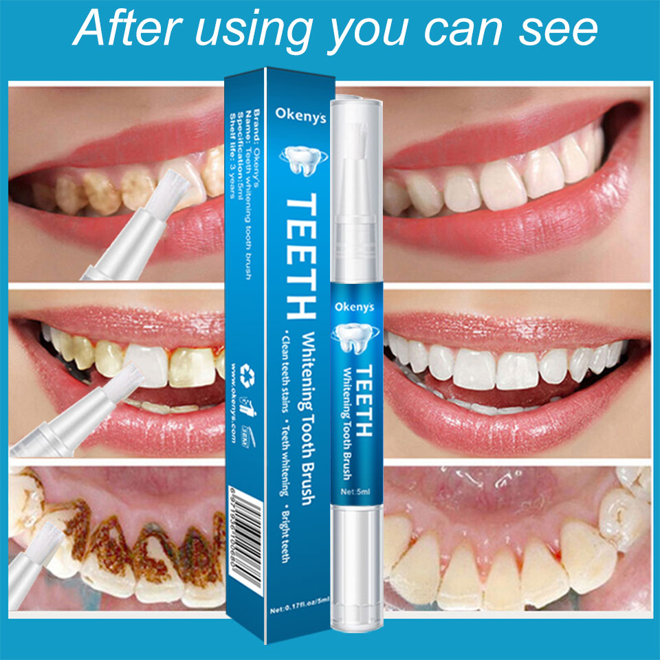 5ml diş beyazlatma kiti temiz  - Whitening Pen Bleach incelemesi ve fiyatı