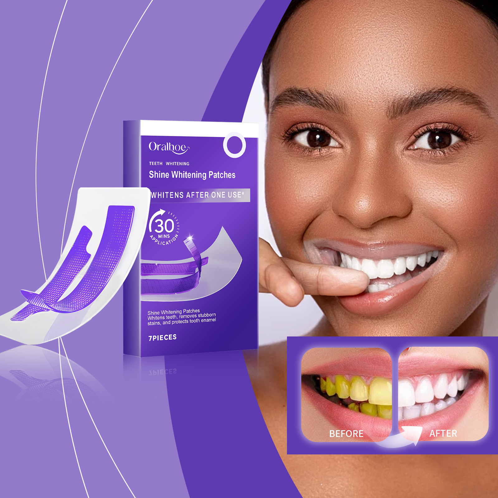 Mor Diş Beyazlatma Şeritleri – - Teeth Whitening Retainer incelemesi ve fiyatı
