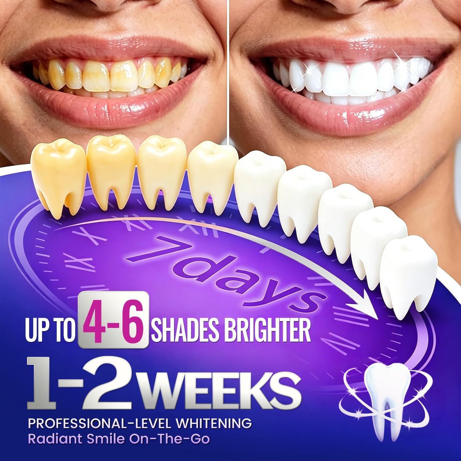 7 çift Diş Beyazlatma Şeritler - Teeth Whitening Retainer incelemesi ve fiyatı