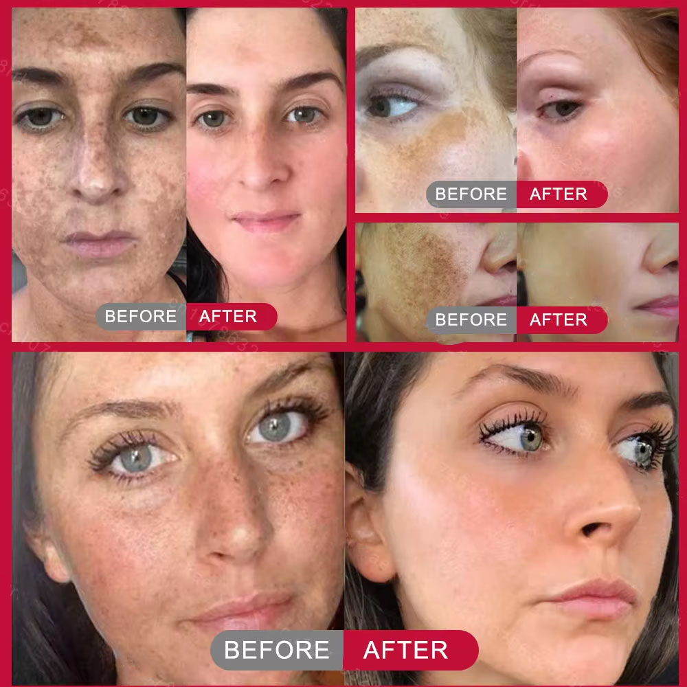 Güçlü Leke Giderici Beyazlatıc - Charcoal Whitening Paste incelemesi ve fiyatı
