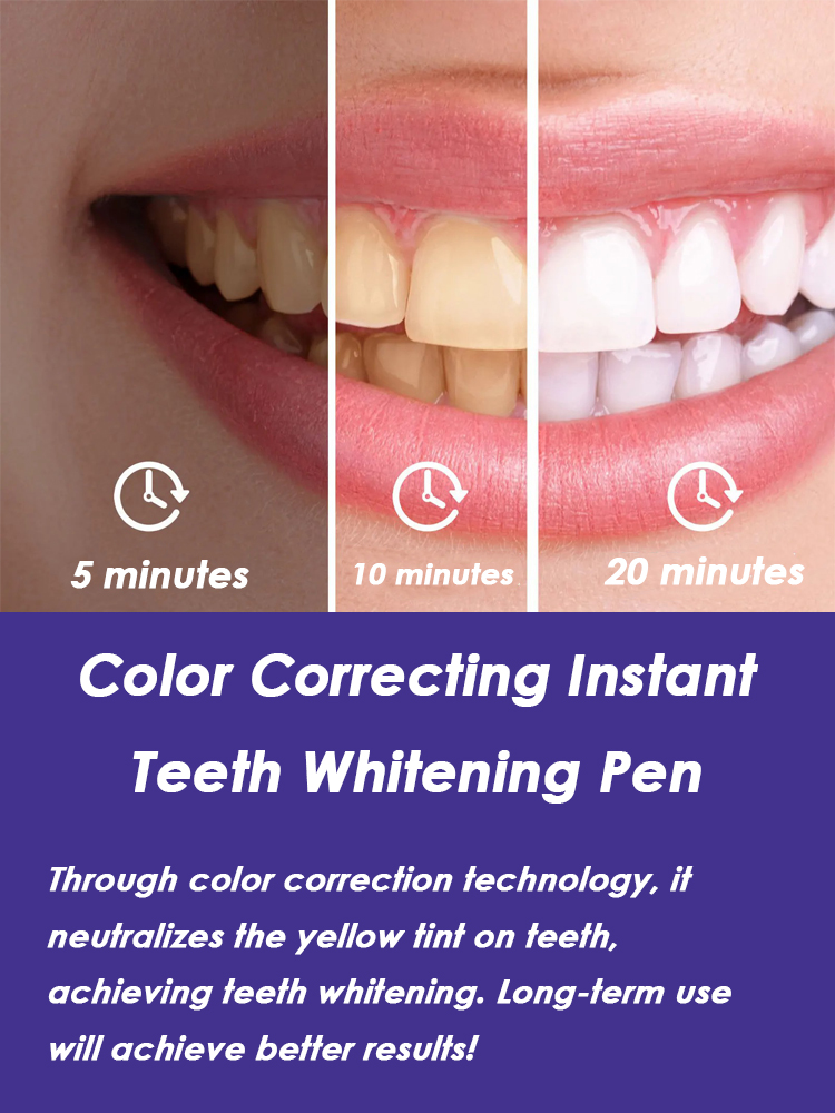 Diş Beyazlatma Kalemi Etkili P - Whitening Pen Bleach incelemesi ve fiyatı