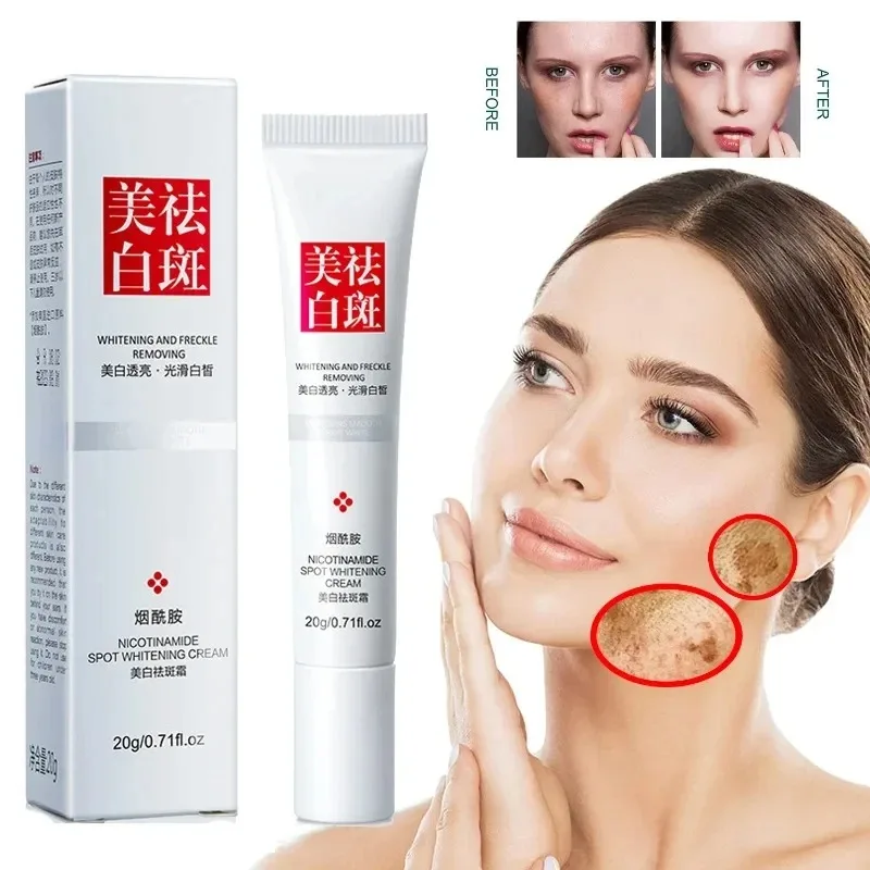 Solur Çil Koyu Noktalar Yüz Kr - Charcoal Whitening Paste incelemesi ve fiyatı