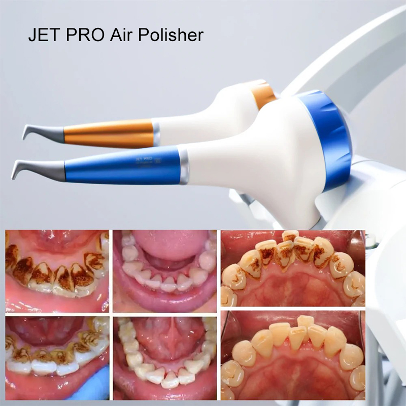 VV Dental Hava Parlatma Prophy - Teeth Whitening Free incelemesi ve fiyatı