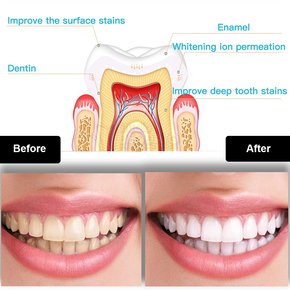 Diş Diş Beyazlatma Kiti Mini 1 - Whitening Pen Bleach incelemesi ve fiyatı