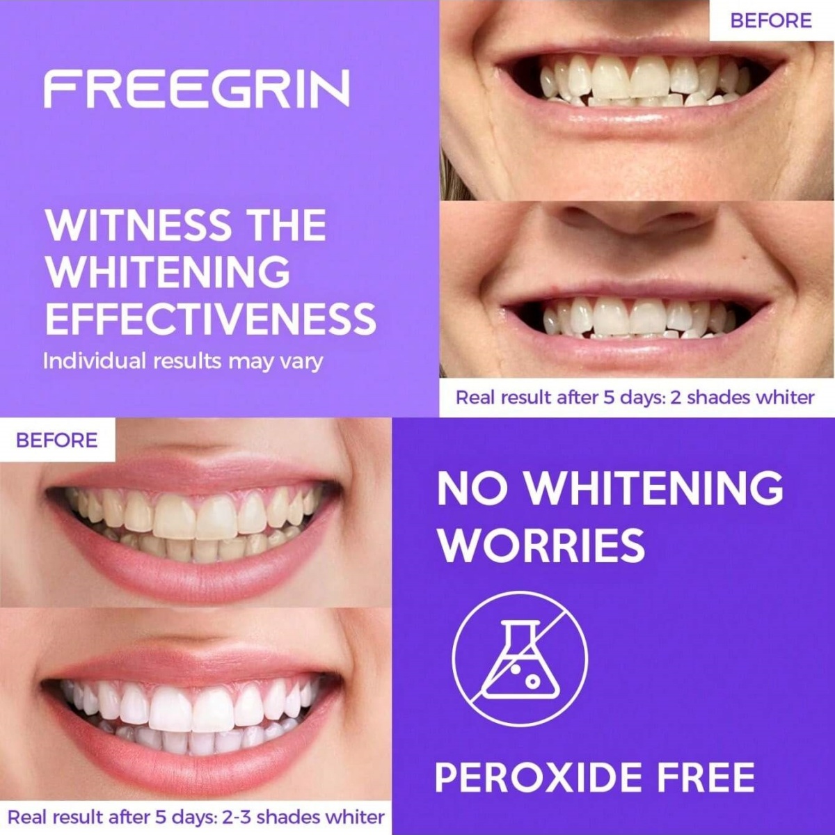 Deluxe Beyazlatma Diş Çıkartma - Teeth Whitening Retainer incelemesi ve fiyatı