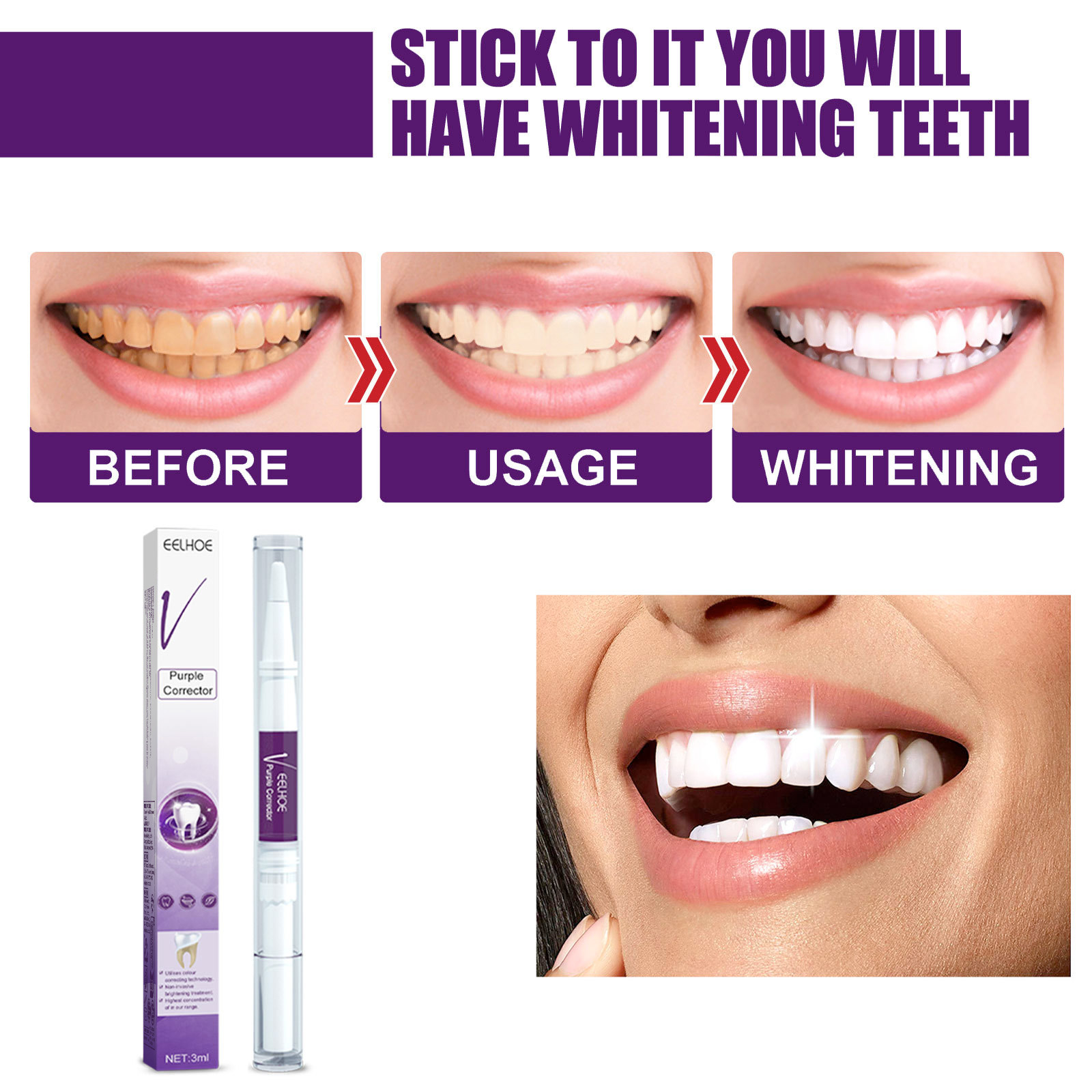 Mor Diş Beyazlatma Diş Macunu  - Whitening Pen Bleach incelemesi ve fiyatı