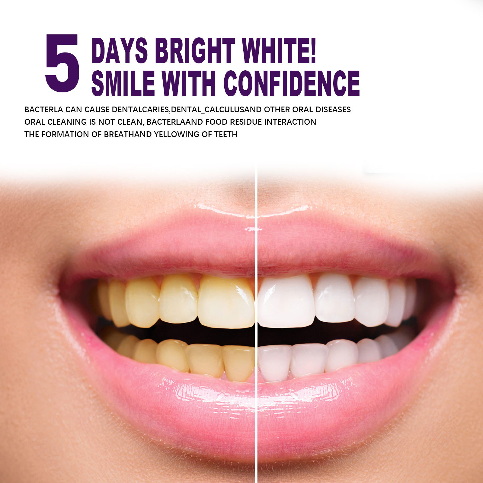 Mor Diş Beyazlatma Diş Macunu  - Whitening Pen Bleach incelemesi ve fiyatı