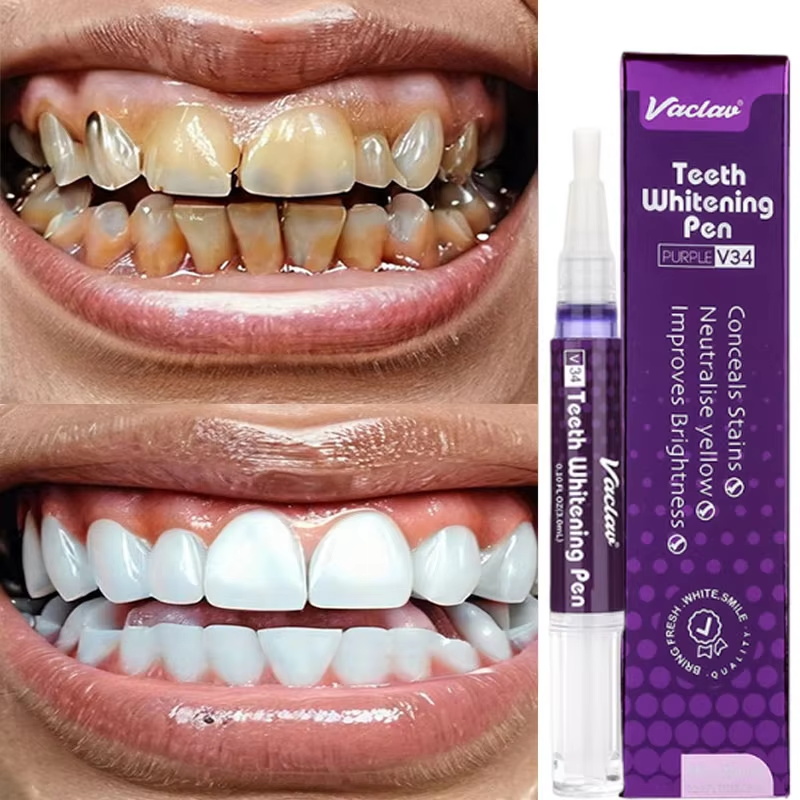 V34 Diş Beyazlatma Kalemi Diş  - Whitening Pen Bleach incelemesi ve fiyatı