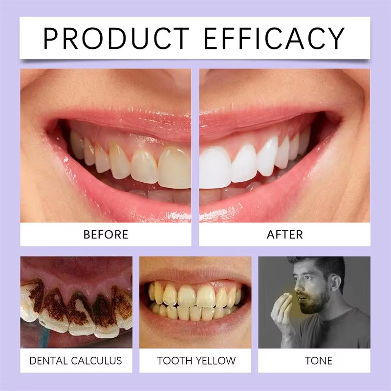 V34 Diş Beyazlatma Kalemi Diş  - Whitening Pen Bleach incelemesi ve fiyatı