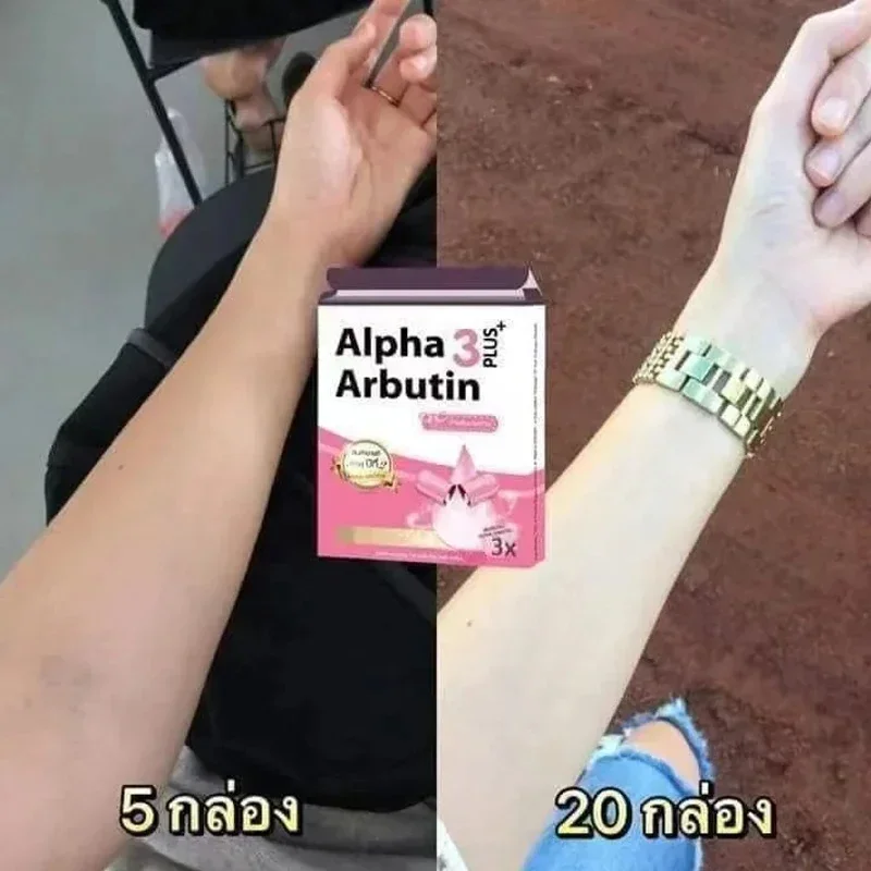 Alpha Arbutin 3Plus Losyonlu P - Charcoal Whitening Paste incelemesi ve fiyatı