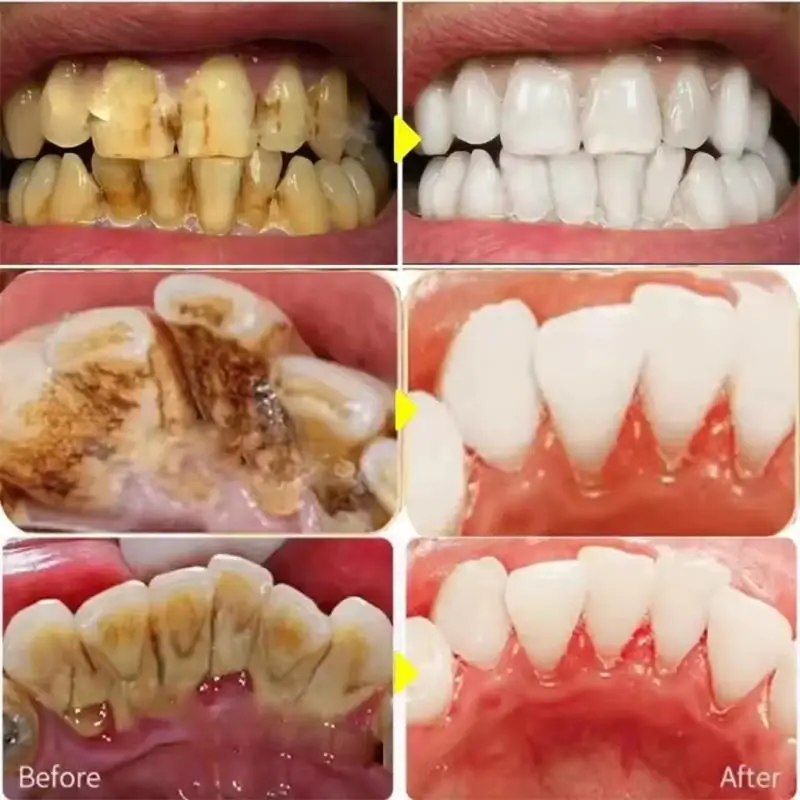 Hızlı Diş Beyazlatma Diş Macun - Whitening Pen Bleach incelemesi ve fiyatı