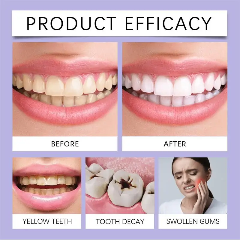 Hızlı Diş Beyazlatma Diş Macun - Whitening Pen Bleach incelemesi ve fiyatı