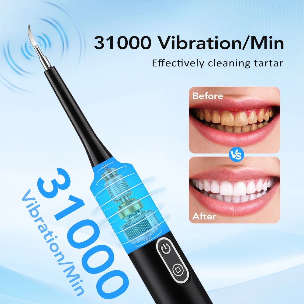 Elektrikli Sonik Titreşimli Di - Teeth Whitening Professional incelemesi ve fiyatı